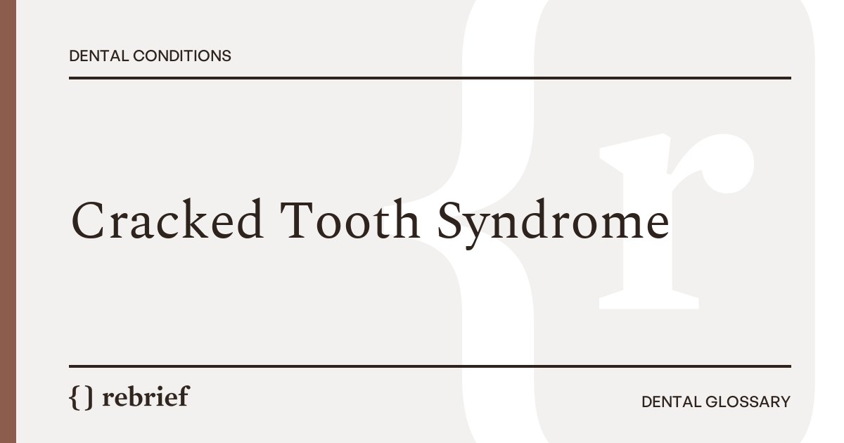 Cracked Tooth Syndrome