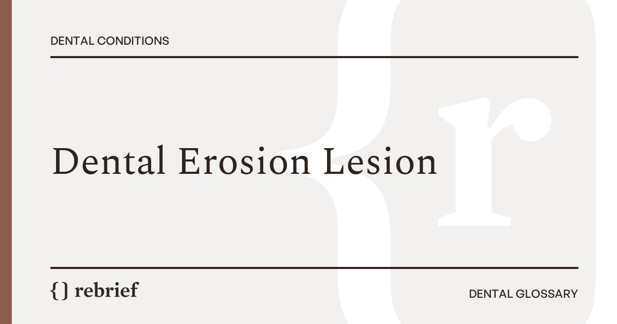 Dental Erosion Lesion