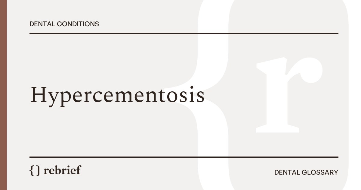 Hypercementosis