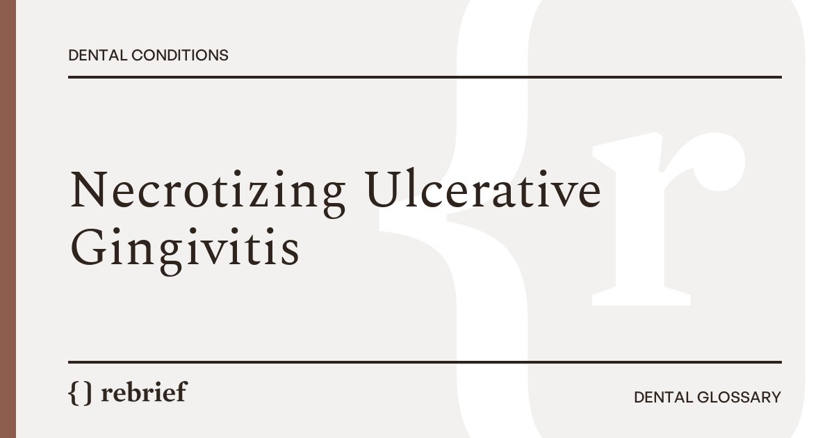 Necrotizing Ulcerative Gingivitis