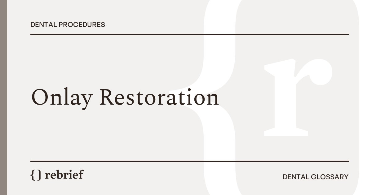 Onlay Restoration
