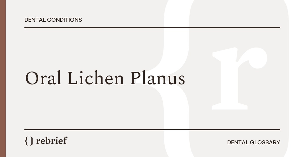 Oral Lichen Planus