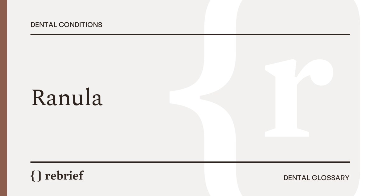 Ranula